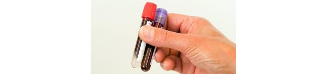 Onderzoeken in het Ziekenhuis.